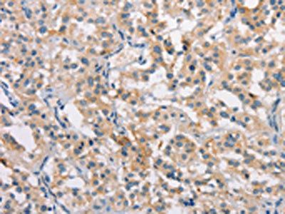 CLDN11 antibody