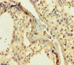 CLDN12 antibody