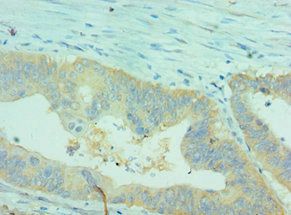 CLDN2 Antibody