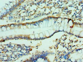 CLDN2 Antibody