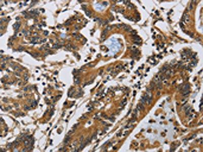 CLDN2 Antibody