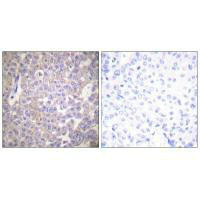 CLDN2 antibody