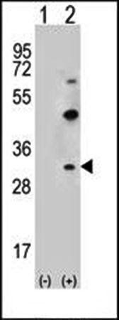 CLDN2 antibody