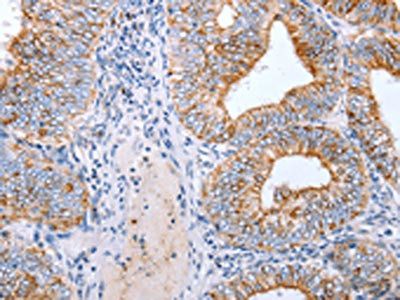 CLDN3 antibody