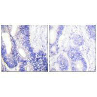 CLDN3 Antibody