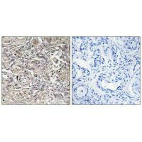 CLDN6 Antibody