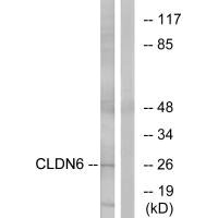 CLDN6 Antibody