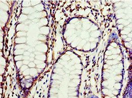 CLDN8 antibody