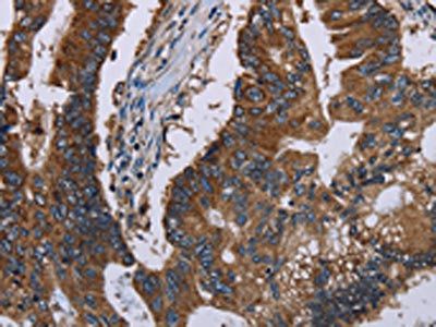 CLDND1 Antibody