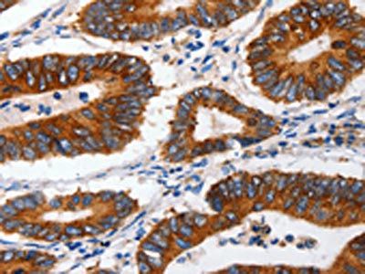 CLDND1 antibody