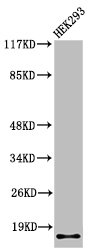 ITGA5 Antibody