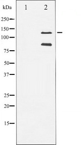 Cleaved-PARP1 (A214) Antibody