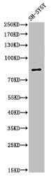 Cleaved-PARP1 (D214) Antibody