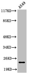 Cleaved-PARP1 (D214) antibody
