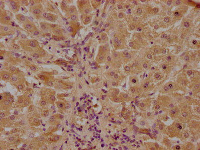CLEC10A Antibody