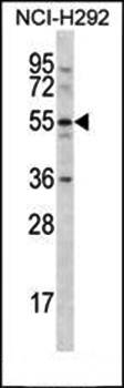 CLEC18A antibody