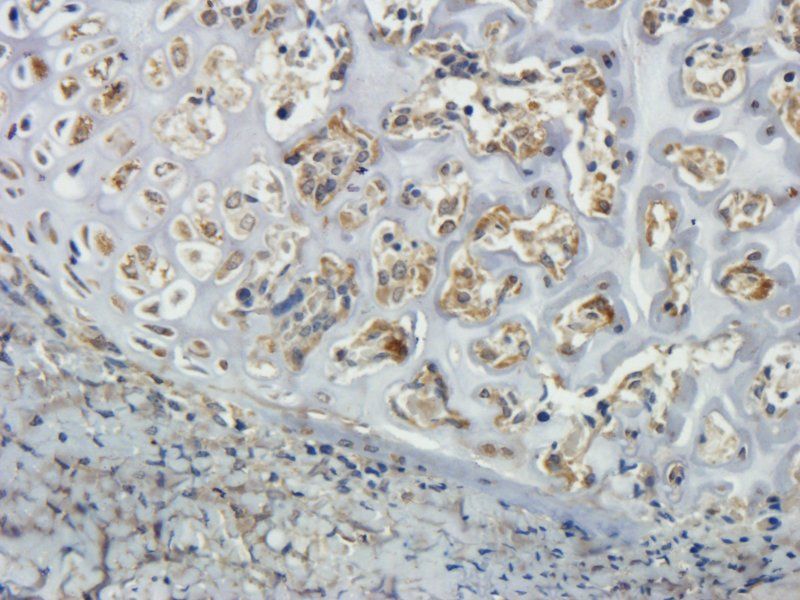 CLEC1B antibody