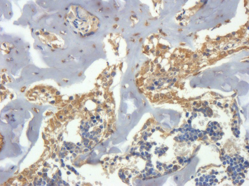 CLEC1B antibody