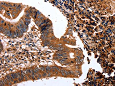 CLEC4A Antibody