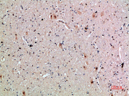 CLEC4A Antibody