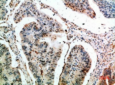 CLEC4A antibody