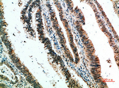 CLEC4A Antibody