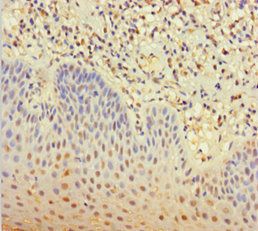 CLEC4D Antibody