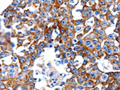 CLEC7A Antibody