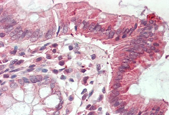 Goat anti-CLIC1 / NCC27 Antibody