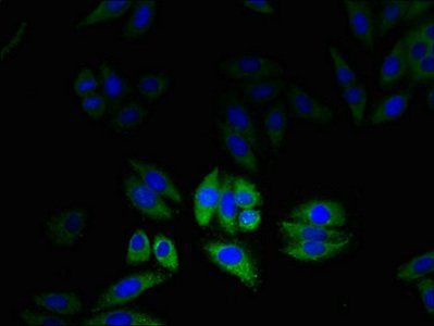 CLIC2 antibody