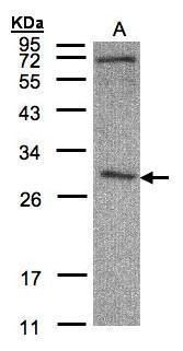 CLIC3 antibody [N1C3]