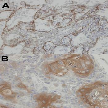 CLIC3 antibody