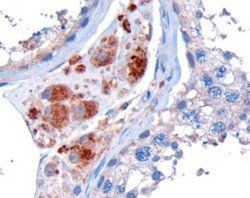 Goat anti-Clik1 / STK35 Antibody