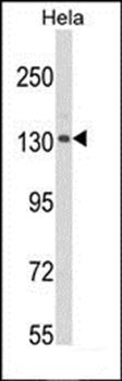 CLIP1 antibody