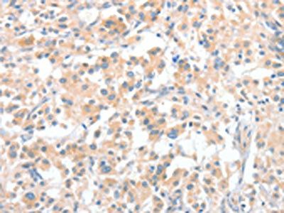 CLIP1 Antibody