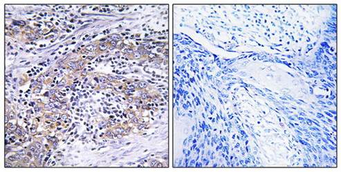 CLN6 antibody