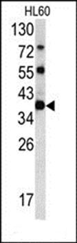 CLNS1A antibody