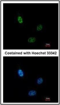 CLP1 antibody [N3C3]