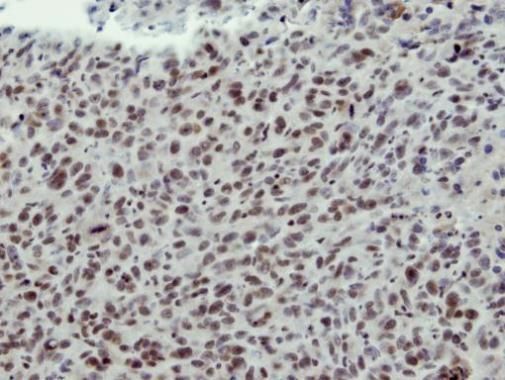 CLP1 antibody [N3C3]