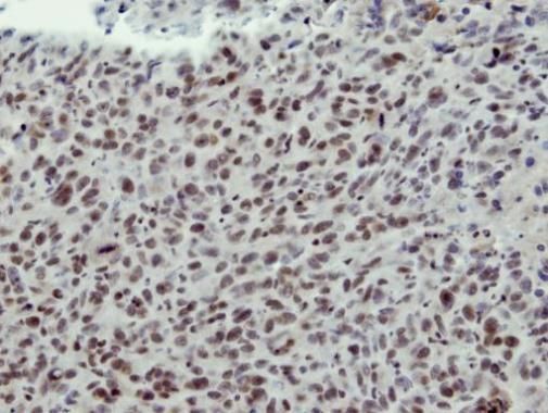 CLP1 antibody