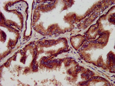 CLPP Antibody