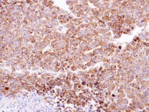 CLPP antibody [C2C3], C-term