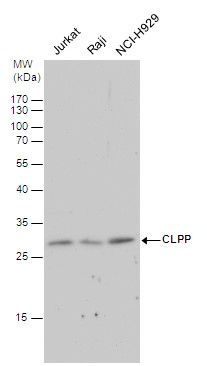 CLPP antibody [C2C3], C-term