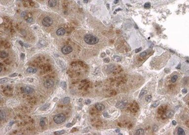 Goat anti-CLPP Antibody