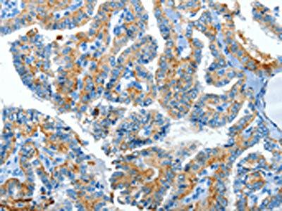 CLPTM1L Antibody