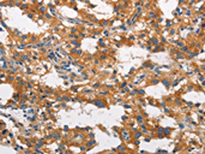 CLTC Antibody