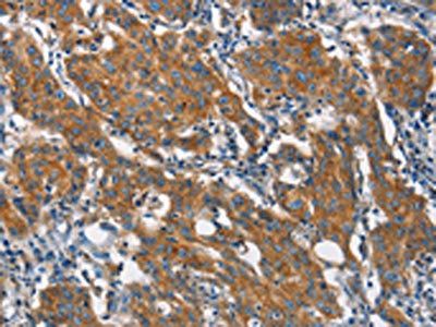 CLTC Antibody