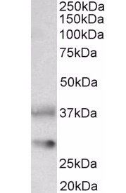 Goat anti-Clusterin / ApoJ (mouse) Antibody