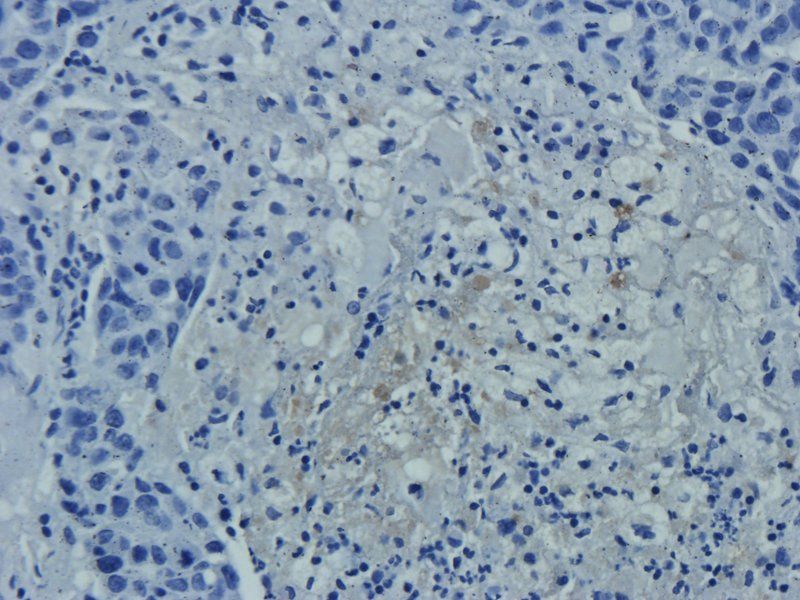 CLU antibody