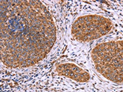 CLUAP1 Antibody
